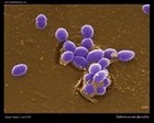 Enterococcus faecalis electron microscopy